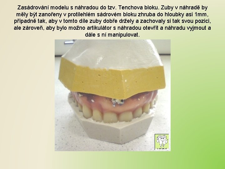 Zasádrování modelu s náhradou do tzv. Tenchova bloku. Zuby v náhradě by měly být