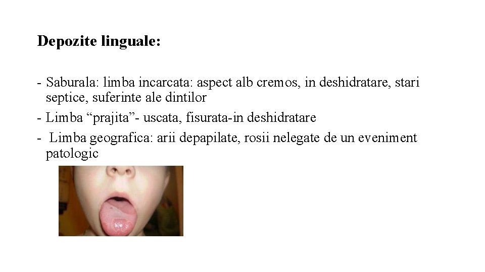 Depozite linguale: - Saburala: limba incarcata: aspect alb cremos, in deshidratare, stari septice, suferinte