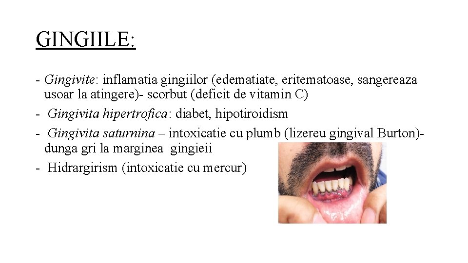 GINGIILE: - Gingivite: inflamatia gingiilor (edematiate, eritematoase, sangereaza usoar la atingere)- scorbut (deficit de