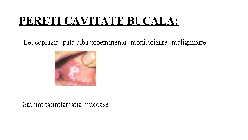 PERETI CAVITATE BUCALA: - Leucoplazia: pata alba proeminenta- monitorizare- malignizare - Stomatita: inflamatia mucoasei