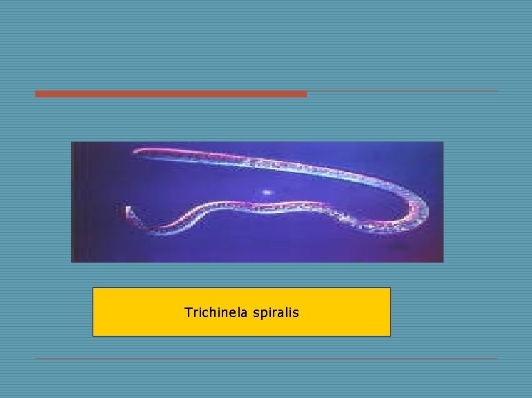 Trichinela spiralis 