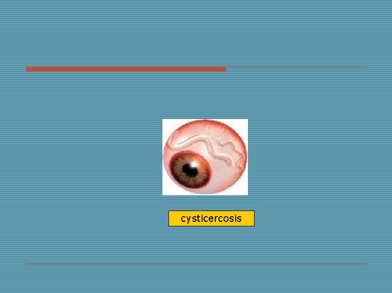 cysticercosis 