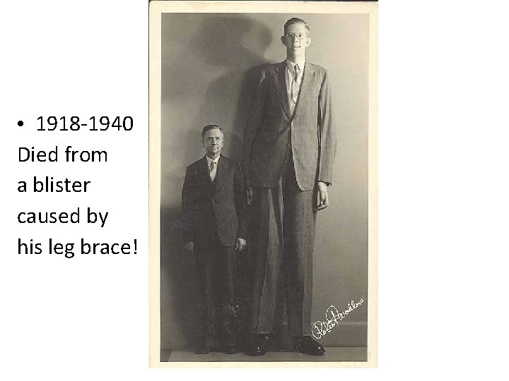  • 1918 -1940 Died from a blister caused by his leg brace! 