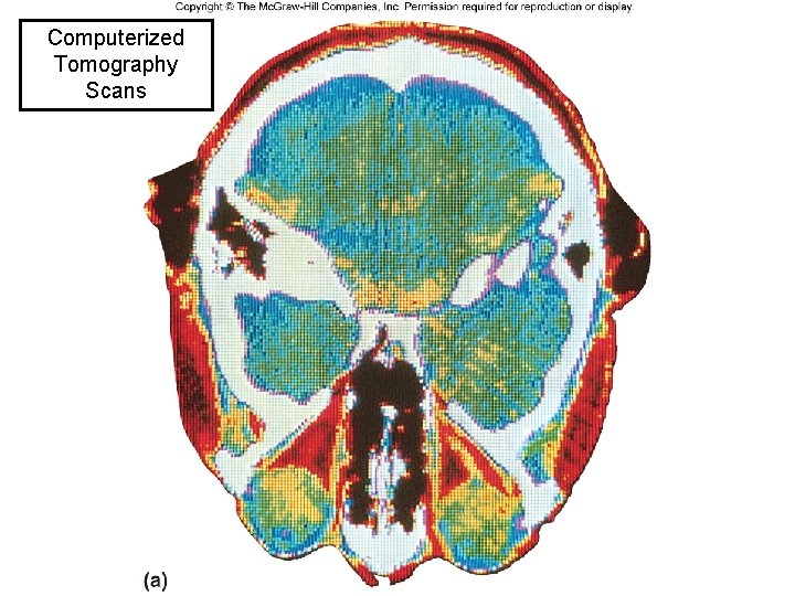 Computerized Tomography Scans Box Figure 01. 01 a 