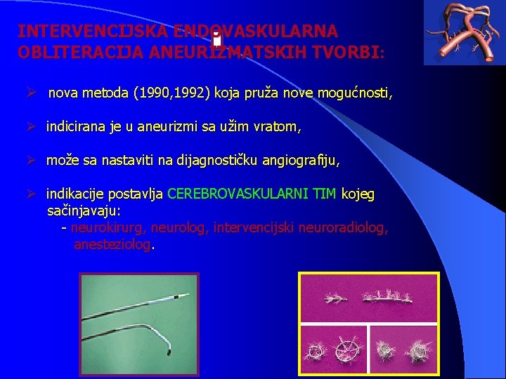 INTERVENCIJSKA ENDOVASKULARNA OBLITERACIJA ANEURIZMATSKIH TVORBI: Ø nova metoda (1990, 1992) koja pruža nove mogućnosti,