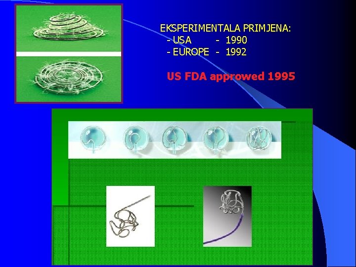 EKSPERIMENTALA PRIMJENA: - USA - 1990 - EUROPE - 1992 US FDA approwed 1995