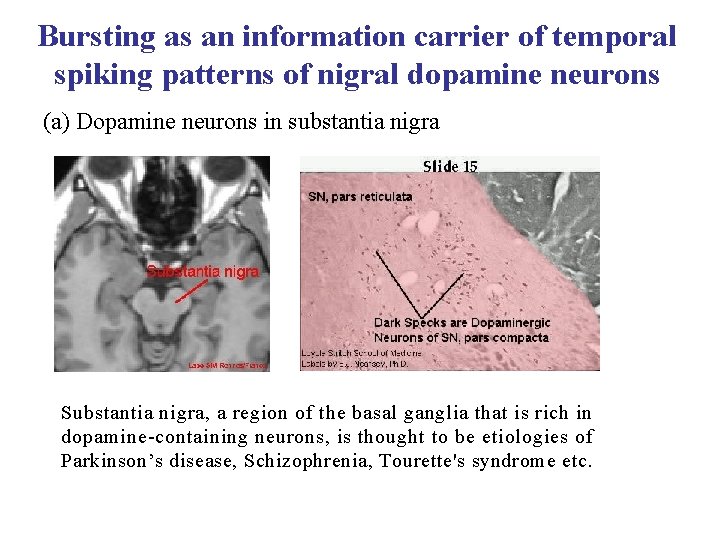 Bursting as an information carrier of temporal spiking patterns of nigral dopamine neurons (a)