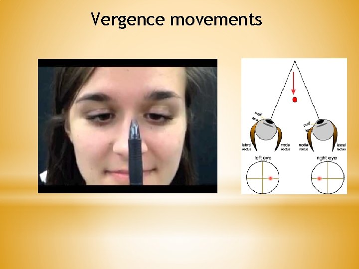 Vergence movements 