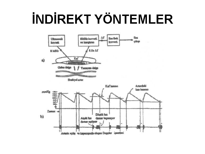 İNDİREKT YÖNTEMLER 