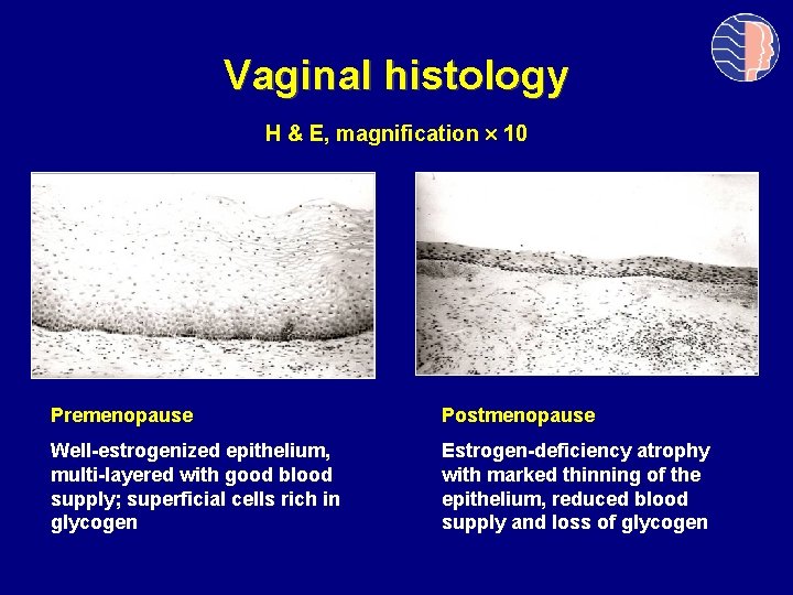 Vaginal histology H & E, magnification 10 Premenopause Postmenopause Well-estrogenized epithelium, multi-layered with good
