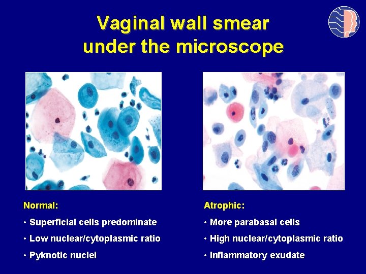 Vaginal wall smear under the microscope Normal: Atrophic: • Superficial cells predominate • More