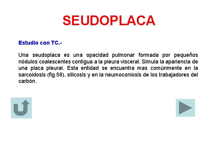 SEUDOPLACA Estudio con TC. Una seudoplaca es una opacidad pulmonar formada por pequeños nódulos