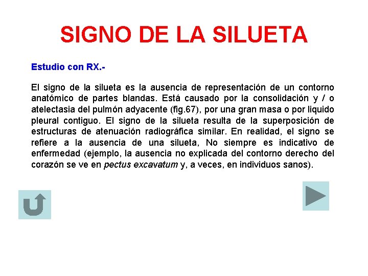 SIGNO DE LA SILUETA Estudio con RX. El signo de la silueta es la