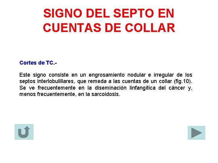 SIGNO DEL SEPTO EN CUENTAS DE COLLAR Cortes de TC. Este signo consiste en