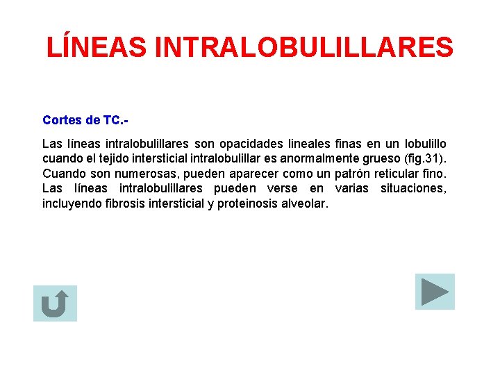 LÍNEAS INTRALOBULILLARES Cortes de TC. Las líneas intralobulillares son opacidades lineales finas en un