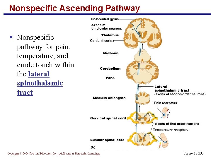 Nonspecific Ascending Pathway § Nonspecific pathway for pain, temperature, and crude touch within the