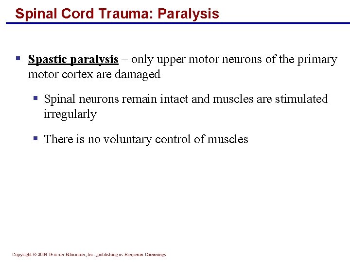 Spinal Cord Trauma: Paralysis § Spastic paralysis – only upper motor neurons of the