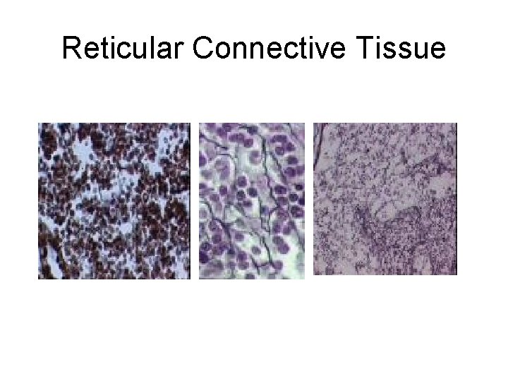 Reticular Connective Tissue 