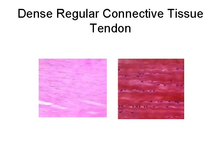 Dense Regular Connective Tissue Tendon 