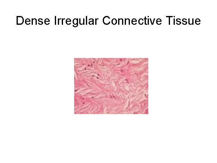 Dense Irregular Connective Tissue 