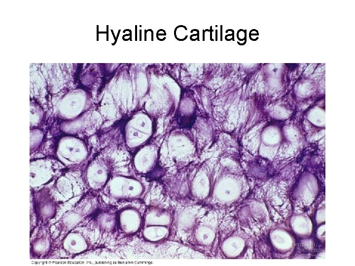 Hyaline Cartilage 