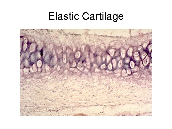 Elastic Cartilage 