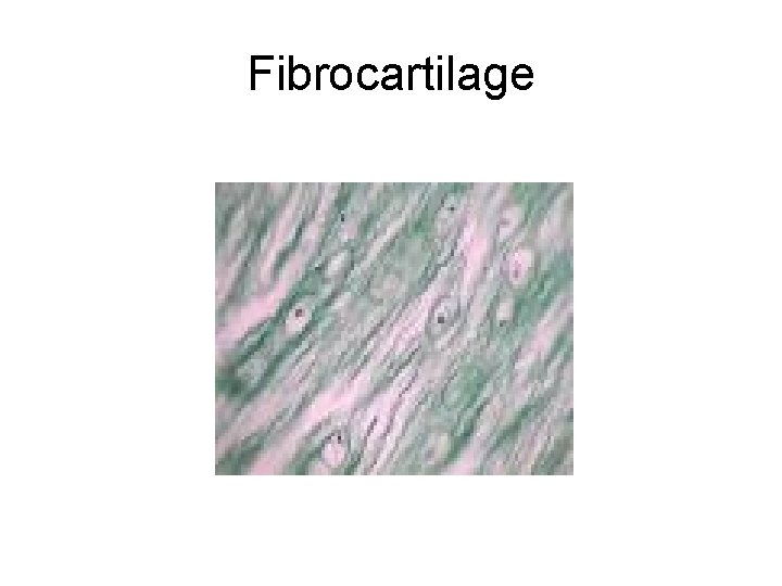 Fibrocartilage 