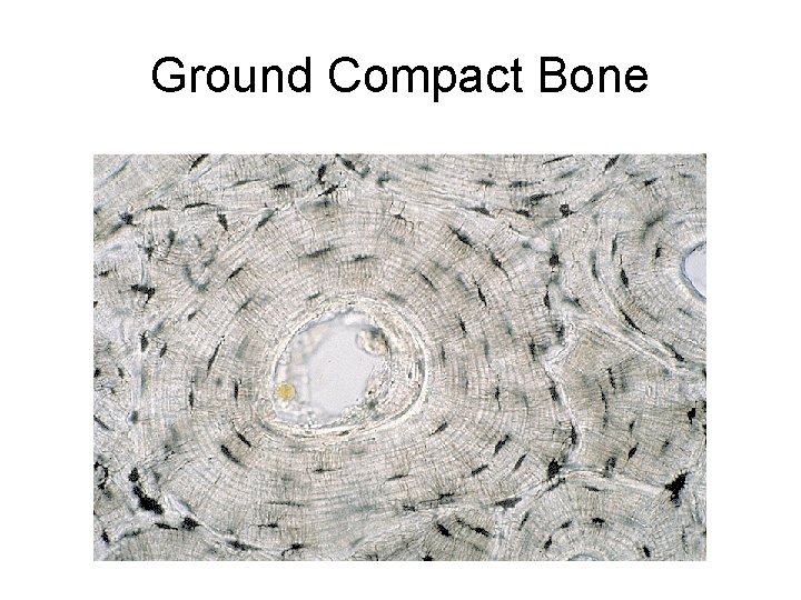 Ground Compact Bone Ground Compact Bone