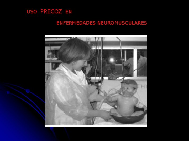 USO PRECOZ EN ENFERMEDADES NEUROMUSCULARES 