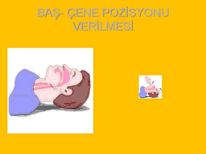 BAŞ- ÇENE POZİSYONU VERİLMESİ 