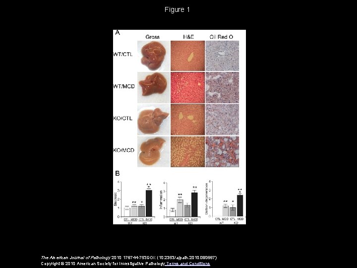 Figure 1 The American Journal of Pathology 2010 176744 -753 DOI: (10. 2353/ajpath. 2010.