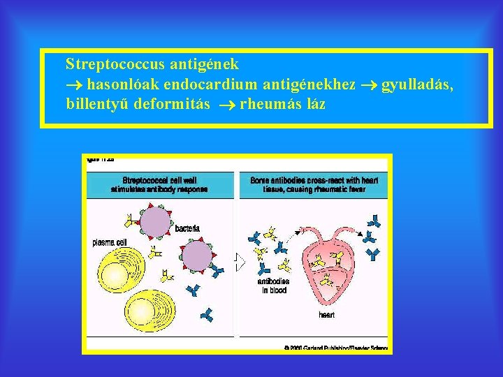 Streptococcus antigének hasonlóak endocardium antigénekhez gyulladás, billentyű deformitás rheumás láz 