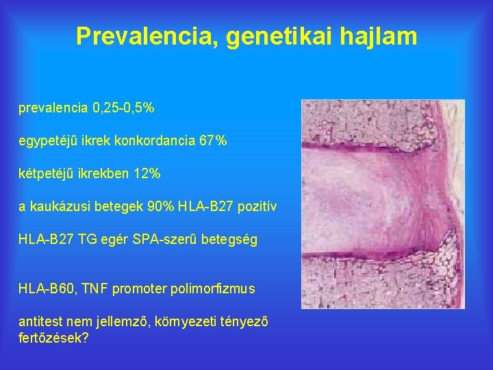 Prevalencia, genetikai hajlam prevalencia 0, 25 -0, 5% egypetéjű ikrek konkordancia 67% kétpetéjű ikrekben
