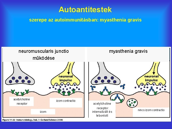 Autoantitestek szerepe az autoimmunitásban: myasthenia gravis neuromuscularis junctio működése acetylcholine receptor izom contractio izom