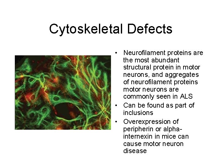 Cytoskeletal Defects • Neurofilament proteins are the most abundant structural protein in motor neurons,