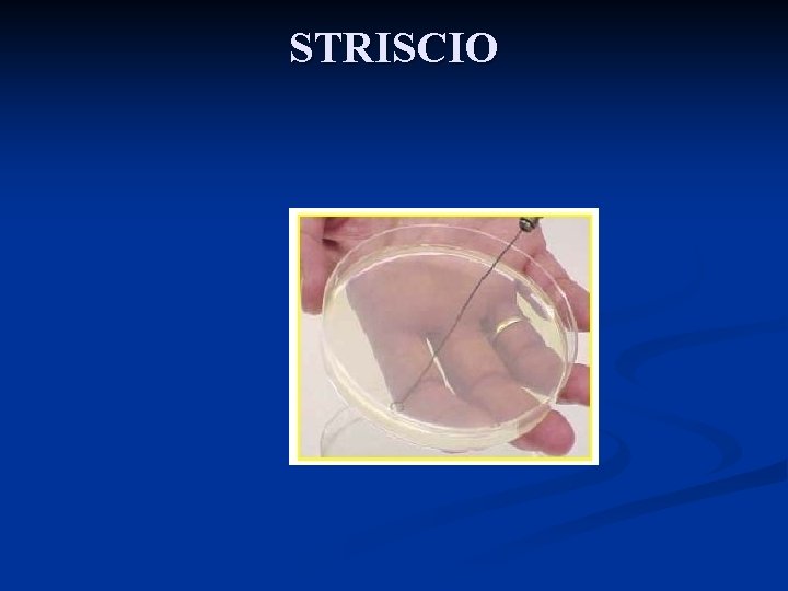 STRISCIO 