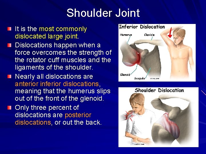 Shoulder Joint It is the most commonly dislocated large joint. Dislocations happen when a