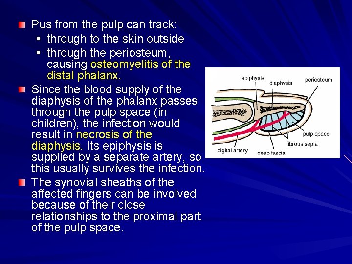 Pus from the pulp can track: § through to the skin outside § through