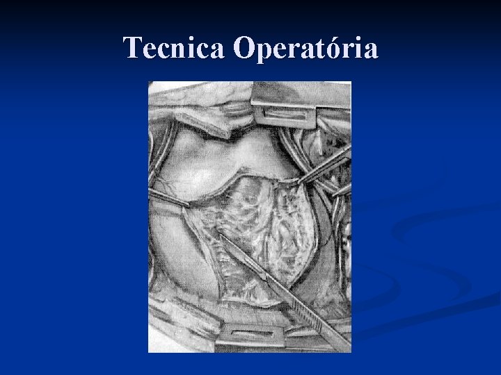 Tecnica Operatória 