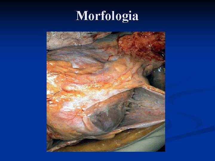 Morfologia 