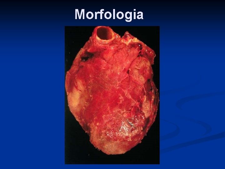 Morfologia 