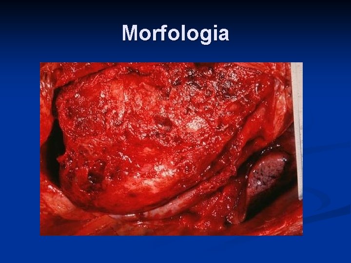 Morfologia 