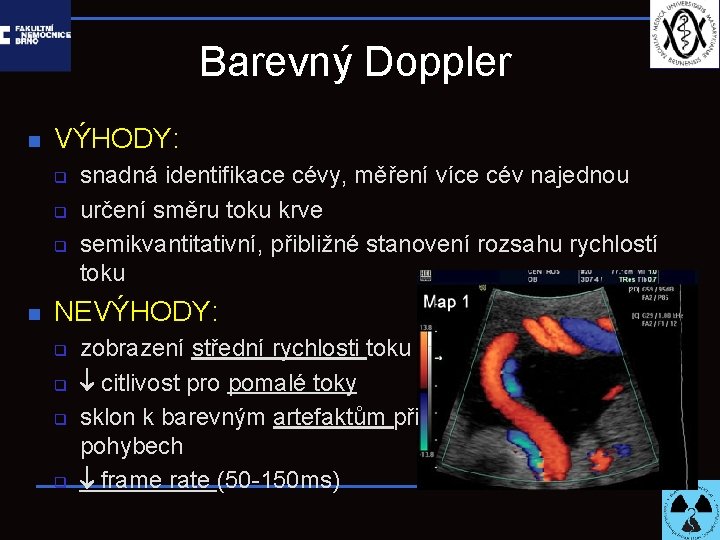 Barevný Doppler n VÝHODY: q q q n snadná identifikace cévy, měření více cév