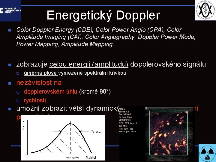 Energetický Doppler n n Color Doppler Energy (CDE), Color Power Angio (CPA), Color Amplitude