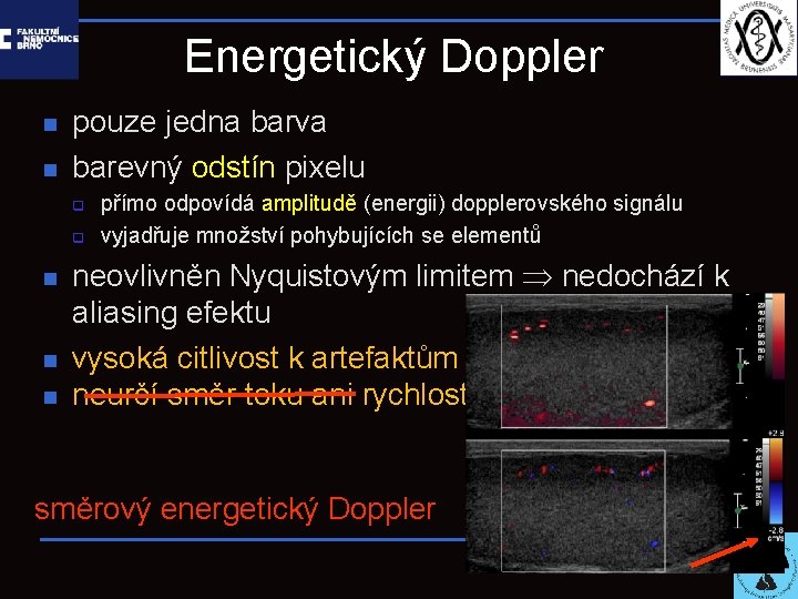 Energetický Doppler n n pouze jedna barva barevný odstín pixelu q q n n