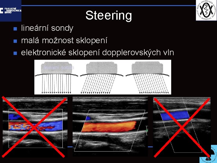 Steering n n n lineární sondy malá možnost sklopení elektronické sklopení dopplerovských vln lineární