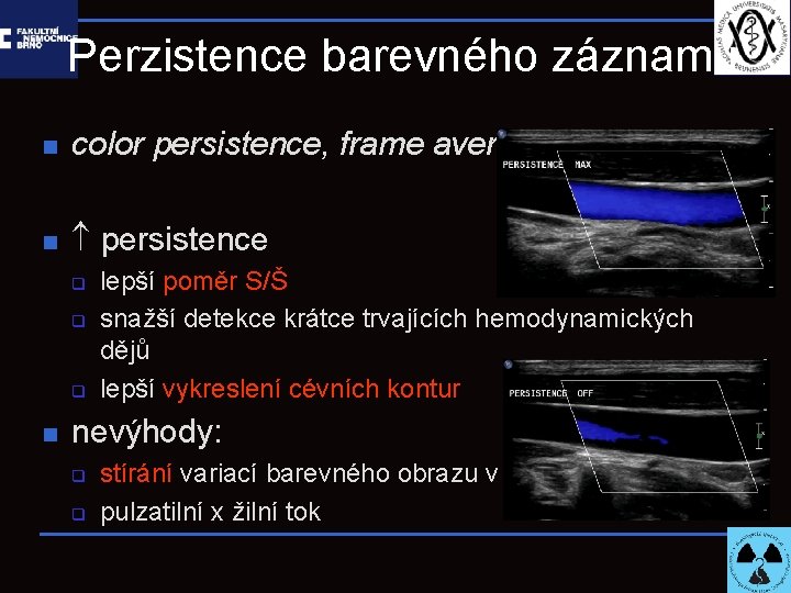 Perzistence barevného záznamu n color persistence, frame averaging n persistence q q q n