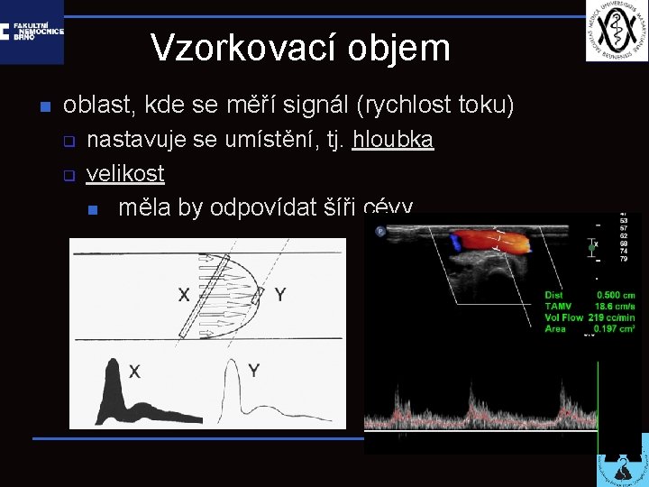 Vzorkovací objem n oblast, kde se měří signál (rychlost toku) q q nastavuje se