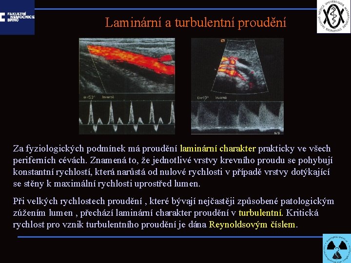 Laminární a turbulentní proudění Za fyziologických podmínek má proudění laminární charakter prakticky ve všech