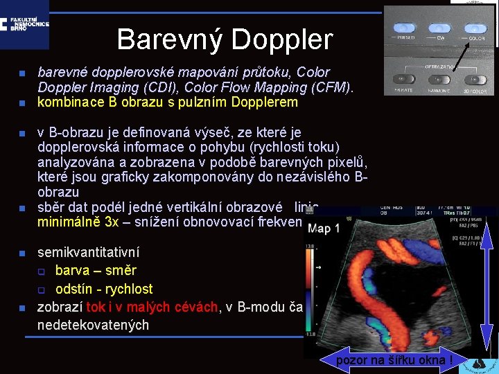 Barevný Doppler n n n barevné dopplerovské mapování průtoku, Color Doppler Imaging (CDI), Color